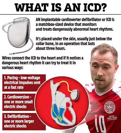 Icd “นวัตกรรมการแพทย์” ช่วย “นักสู้ชีวิต” สู้ชีวิต