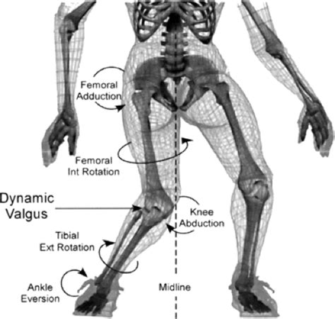 Anterior Cruciate Ligament Injury Prevention Concepts Strategies And