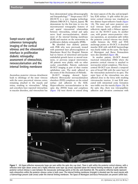 Pdf Swept Source Optical Coherence Tomography Imaging Of The Cortical