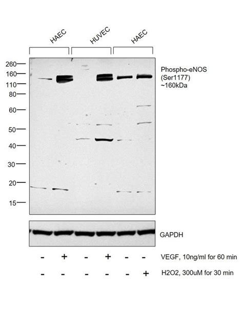 Phospho Enos Ser1177 Antibody Ma5 14957