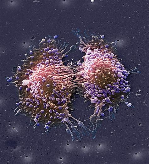 Cancer Cell Division Photograph by Steve Gschmeissner