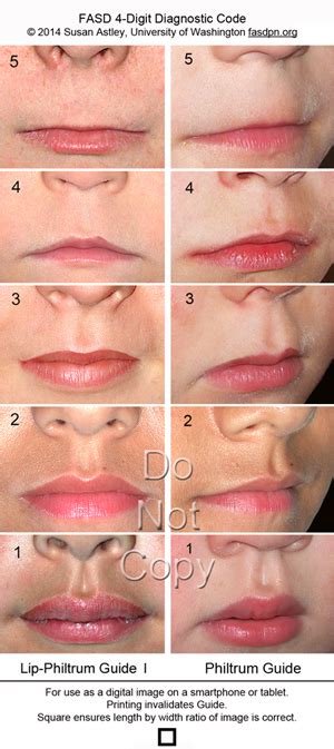 Lip Philtrum Guides