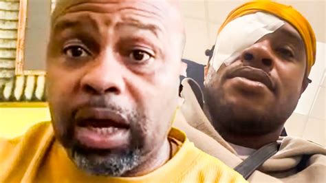 Roy Jones Jr REACTS To Errol Spence CATARACT SURGERY Gives Terence