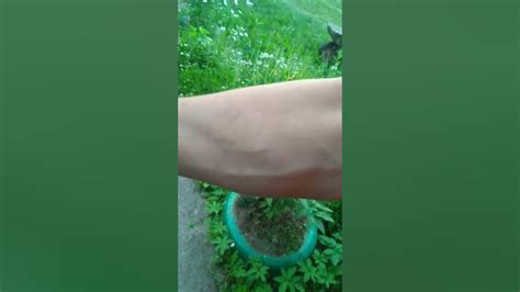 укус красного муравья - YouTube