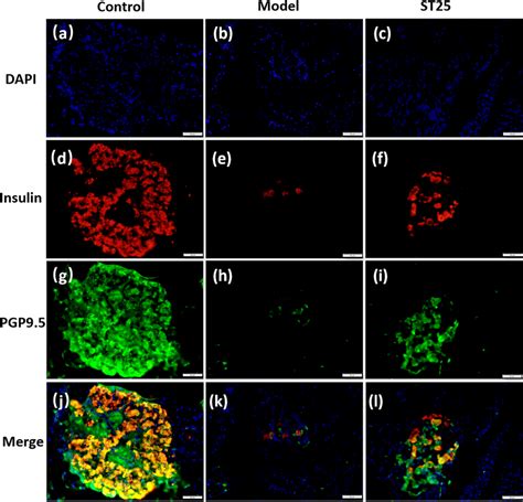 Representative IF Images Of The Pancreas DAPI Stained The Nuclei