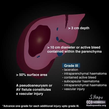 Image Radiopaedia Org