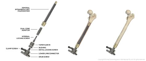 Osseointegration - Osseointegration Group