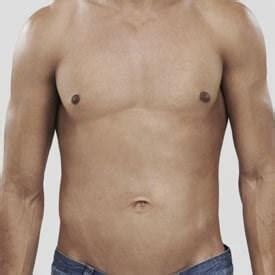 Male Procedures Las Vegas Nv Henderson Male Procedures