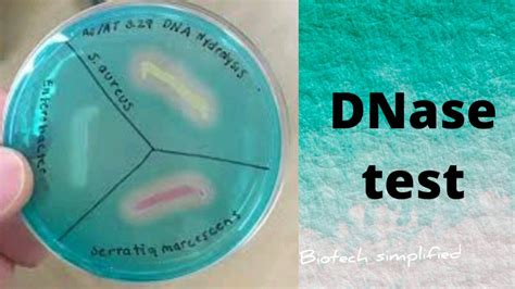 DNA Hydrolysis Test Or Deoxyribonuclease DNase Test YouTube