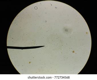 Parasite Microscope Medical Science Background Stock Photo 772734568 ...