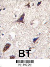 Anti GJB6 Rabbit Polyclonal Antibody VWR