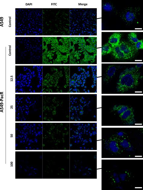 Localization Of Intracellular P Gp Distribution After Treatment With