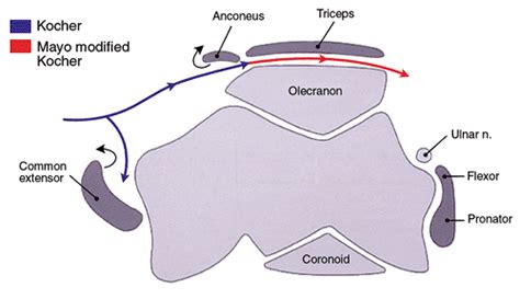 Limited And Extensile Triceps Reflecting And Exposures Of The Elbow