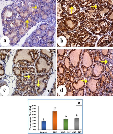 Photomicrographs Of Sections Of The Thyroid Gland A Tissue From Group