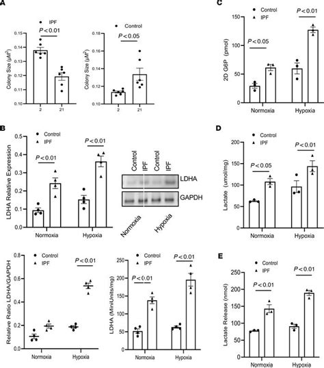 Jci Insight Hypoxia Enhances Ipf Mesenchymal Progenitor Cell