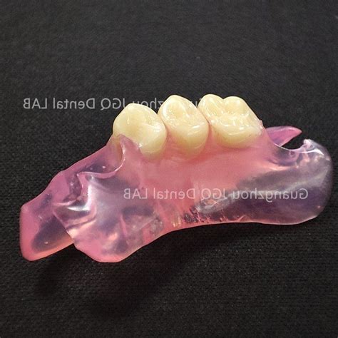 Denture Valplast Flexible Acrylic Resin Dental Flexible Partial