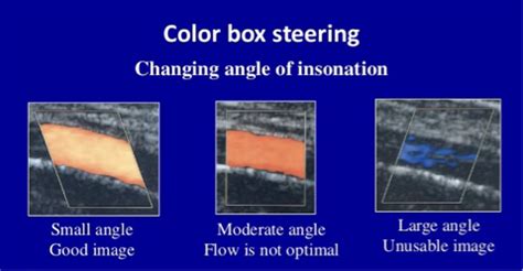 Physics Doppler Study Set Color Scale Spectral Definitions