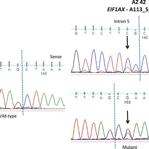 Sequence Chromatogram Showing Eif Axa Splice Site Mutation At The