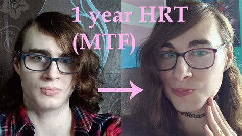 HRT Diary MTF 1 Year On Oestrogen YouTube