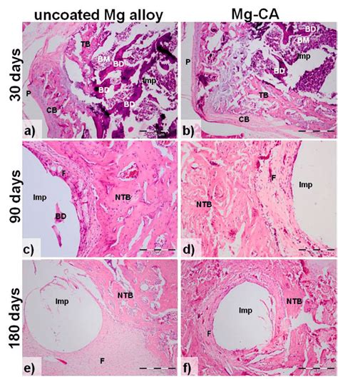 Hematoxylin And Eosin He Staining Of Bone Sections Implanted With The