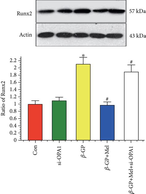 Melatonin Reduced β Gp Induced Calcium Deposition Via Opa1 In Vsmcs