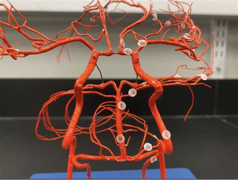 Diagram of Circle of Willis Model | Quizlet