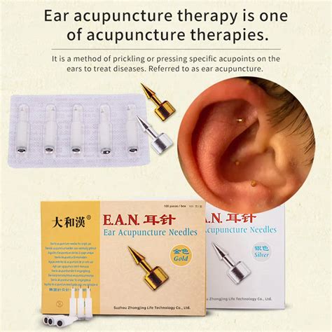 Agulhas De Acupuntura Esterilizadas Press Needle Acupuntura Auricular