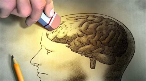 Alzheimer medicamento consegue retardar impactos da demência em 40