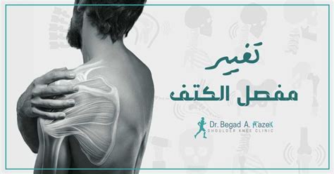 Shoulder joint replacement - Dr Begad Clinic