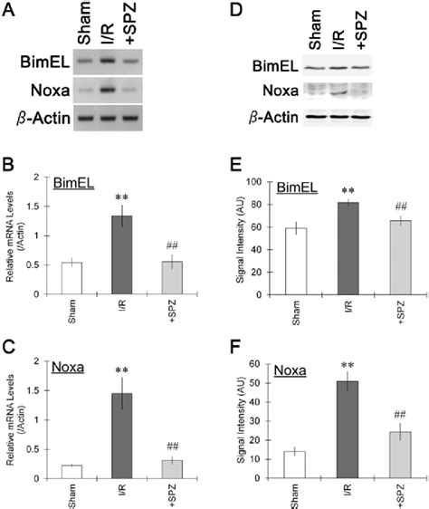 Suppression Of BimEL And Noxa Protein Expression By The Administration