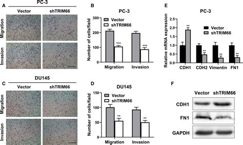 Knockdown Of Trim Inhibited Migration And Invasion Of Prostate Cancer