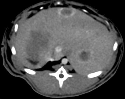 CT Color Mapping Of The Arterial Enhancement Fraction Of VX2 Carcinoma