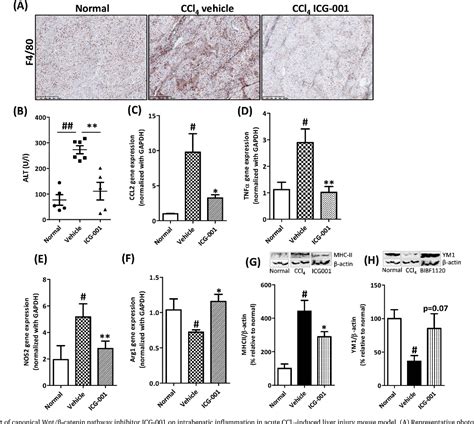 Figure 7 from Inhibition of canonical WNT signaling pathway by β