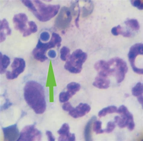 Dermatology Diagnostics Cutaneous Cytology Todays Veterinary Practice