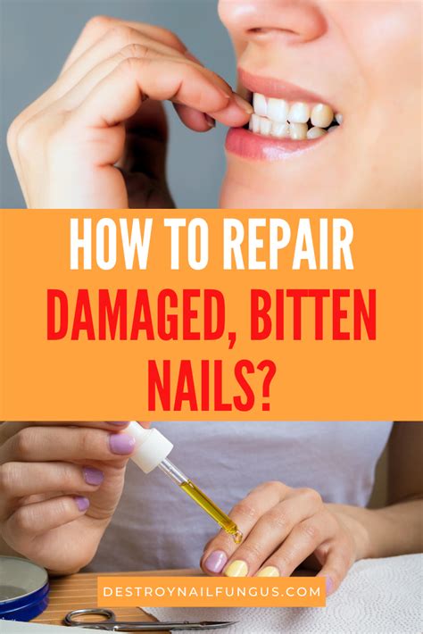 How To Repair Damaged Nails From Biting A Complete Guide