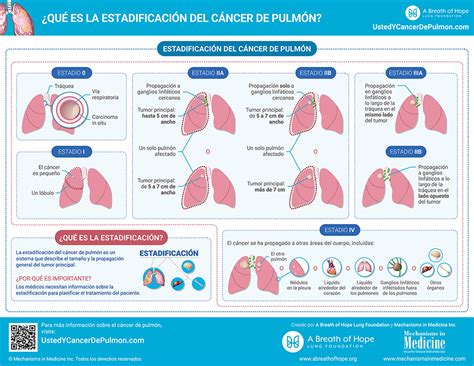 Infografías