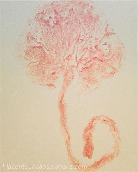 Pin by Columbus Placenta Encapsulatio on Placenta Art & Prints | Art ...