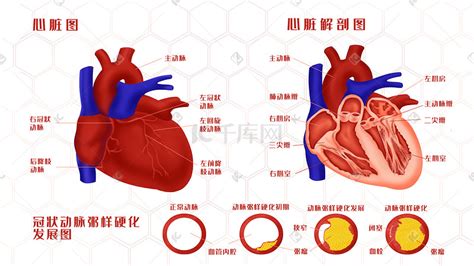 冠状动脉粥样硬化插画 冠状动脉粥样硬化配图 千库网