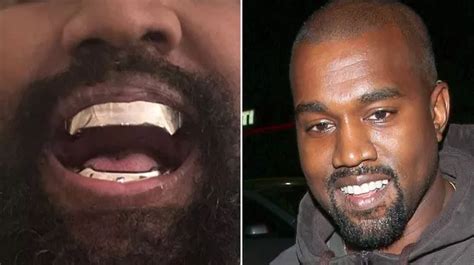 Kanye Wests New 850000 Experimental Titanium Teeth Are Fixed And Permanent Mirror Online