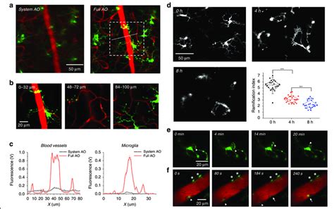 Study Microglial Dynamics And Function In The Mouse Retina A Mosaic