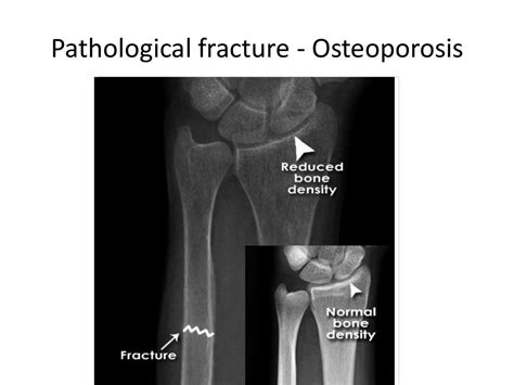 Interpretation Of Musculoskeletal X Rays