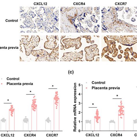 CXCL12 CXCR4 And CXCR7 Are Expressed At A High Level In Placental