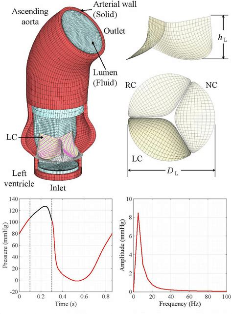 Setup For The FSI Simulation Including The Aorta Model With The