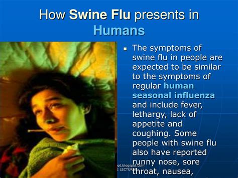 Ppt Swine Flu Powerpoint Presentation Free Download Id528792