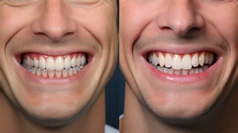 Premium Photo A Photo Of A Patients Smile Transformation With Dentist