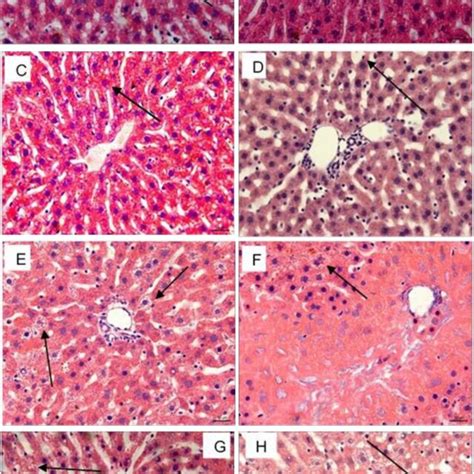 Photomicrographs Of Transversal Sections Of Liver Stained With Download Scientific Diagram