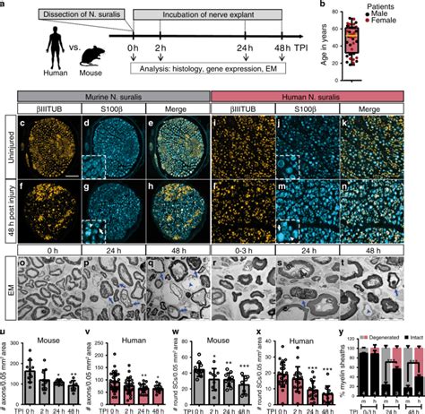 Lipid Metabolism Adaptations Are Reduced In Human Compared To Murine