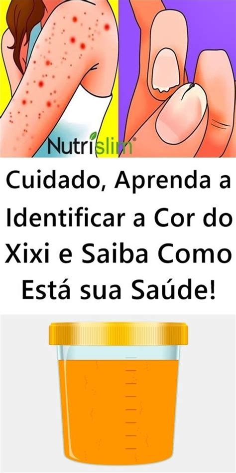 Cuidado Aprenda a Identificar a Cor do Xixi e Saiba Como Está sua