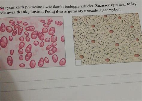 na rysunkach pokazano dwie tkanki budujące szkielet Zaznacz rysunek