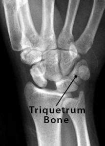 Triquetrum Bone Location, Anatomy, Function, & Diagram | The Skeletal ...